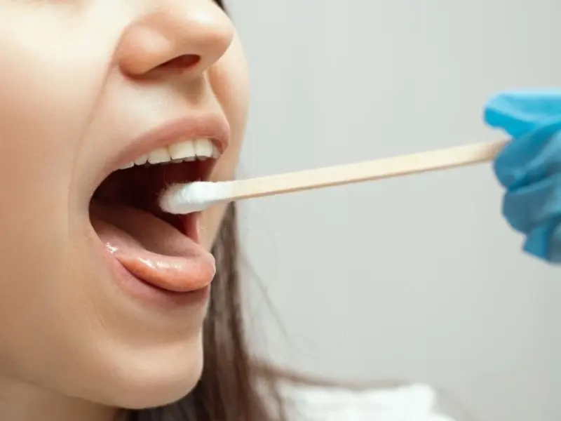 ph en boca - Cómo puedo saber mi pH bucal