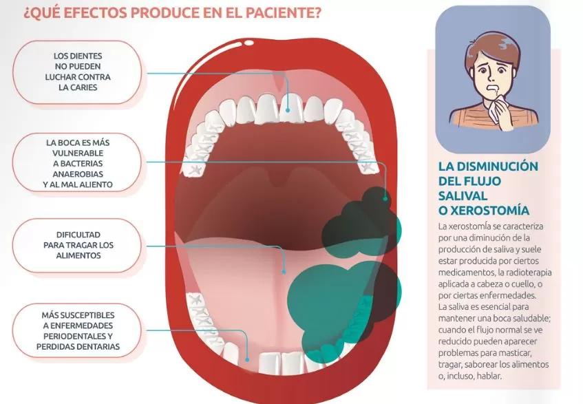 boca seca causas - Cómo saber si la boca seca es por ansiedad