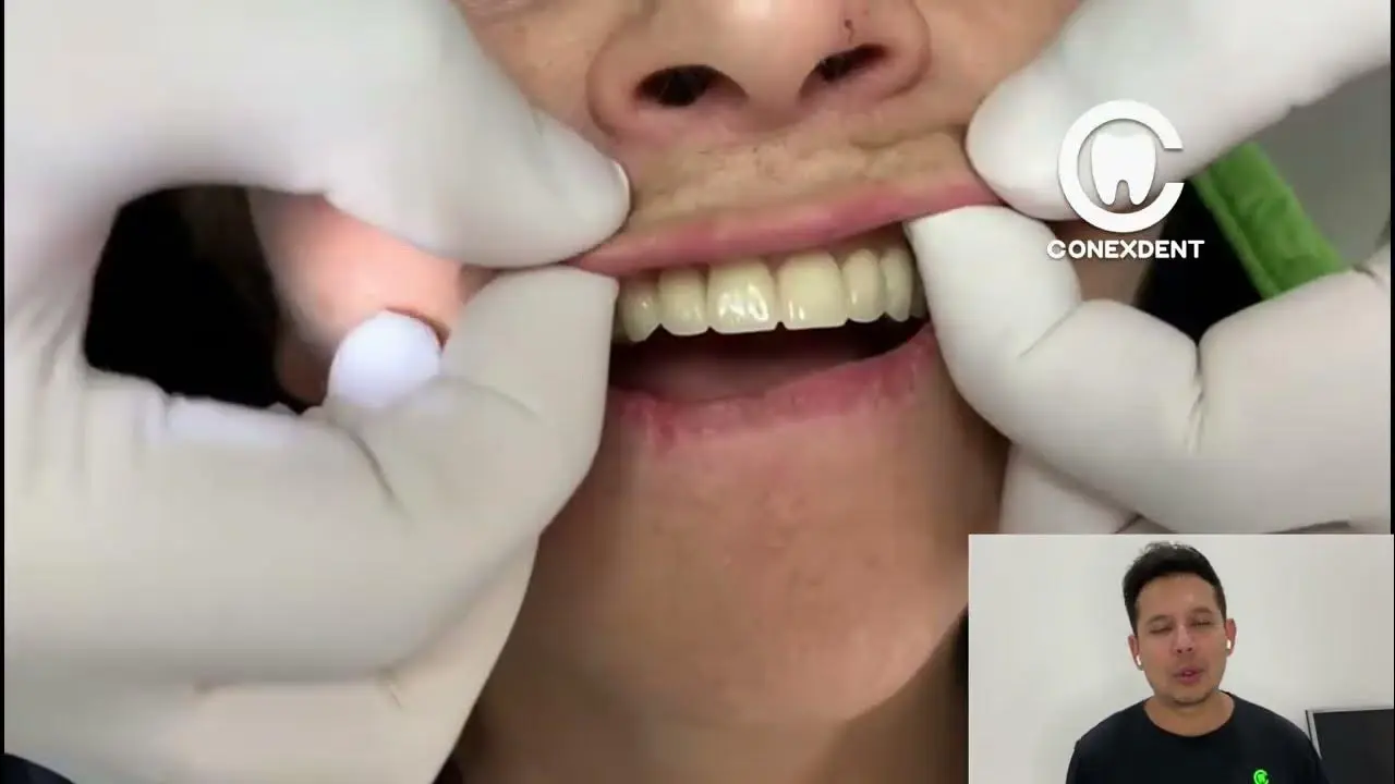 boca succionadora - Por qué no pipetear con la boca
