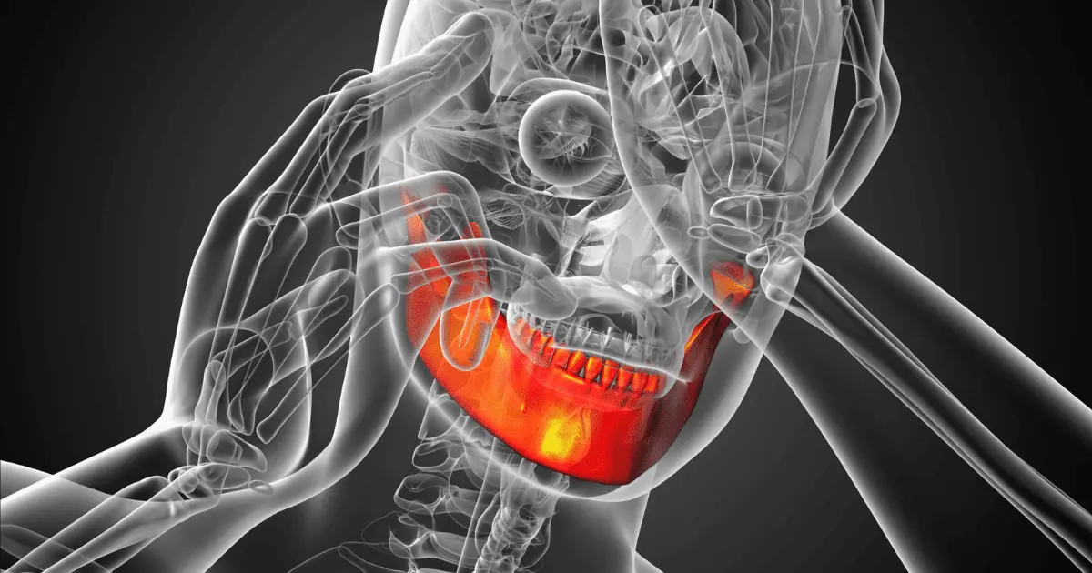 Boca Tensa: Causas, Síntomas, Diagnóstico y Tratamiento - Qué es la tensión dental boca tensa - Qué es la tensión dental