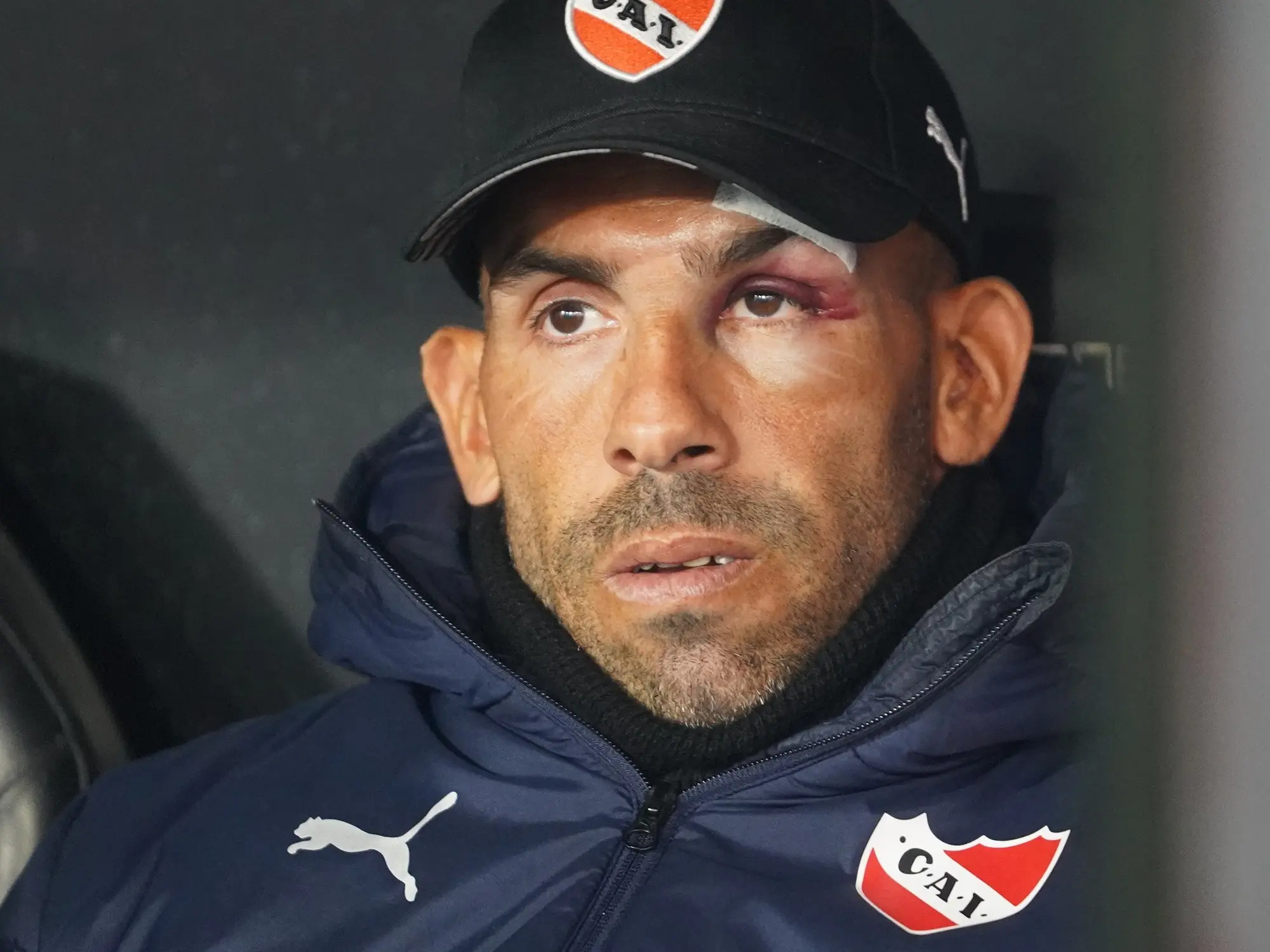 <b>Carlos Tévez deja Boca</b>: Un análisis completo de su retiro y carrera - Qué fue el accidente de Tevez tevez deja boca - Qué fue el accidente de Tevez