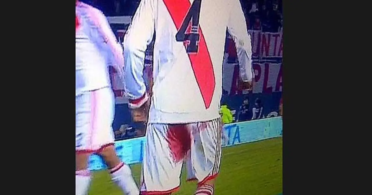 ponzio a boca - Qué le pasó a Ponzio contra Boca Unidos