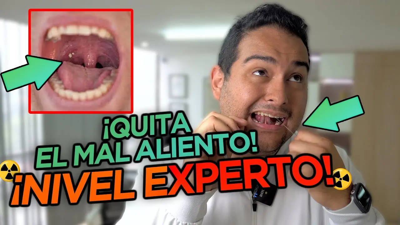 como combatir el mal aliento de la boca - Qué medicamento es bueno para el mal aliento que viene del estómago