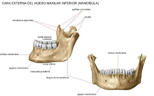 huesos de la boca - Qué pasa si te duele el hueso de la boca