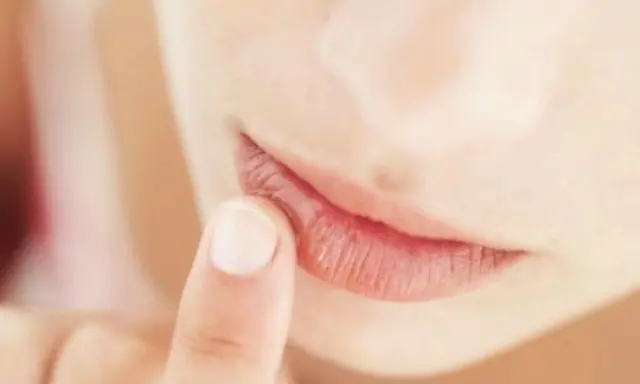 hormigueo en los labios de la boca - Qué puede causar hormigueo en la boca